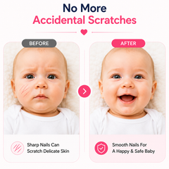 Electric Baby Nail Trimmer – Safe & Quiet Nail File for Newborns, Infants & Toddlers
